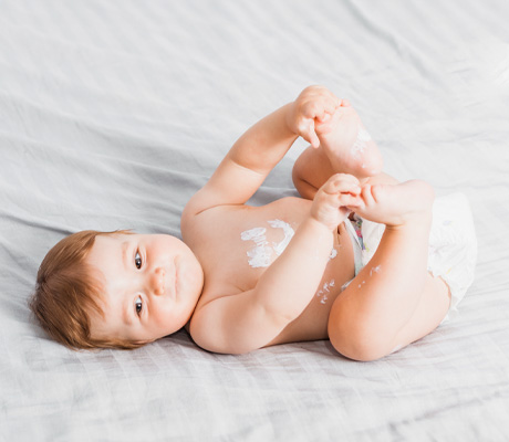 Como auxiliar en el tratamiento de la dermatitis de pañal de tu bebé