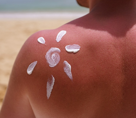 Piel de vacaciones: Después de la exposición solar