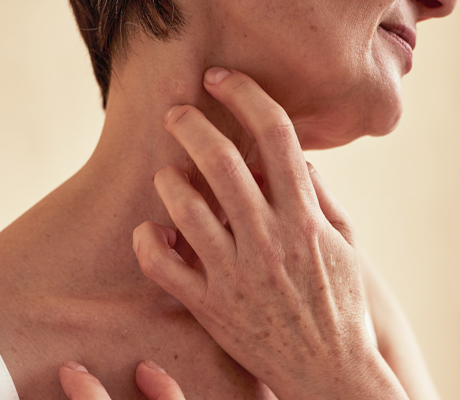 Qué es la comezón y por qué se siente tan bien rascarse