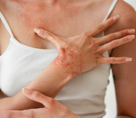 Lesiones en la piel: causas y soluciones