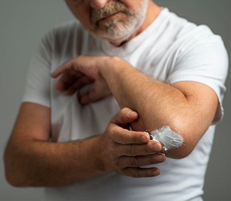 Cómo cuidar una picadura adecuadamente