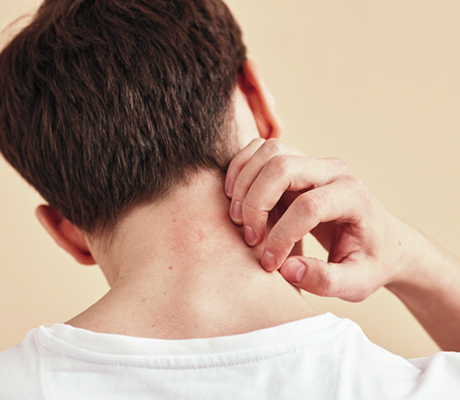 Qué debes hacer si tienes sarpullido