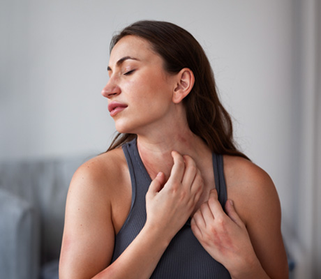 Sarpullido por estrés: Qué es, diagnóstico y cómo tratarlo