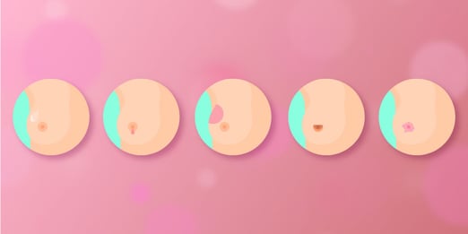 La autoexploraci&oacute;n para examinar tu piel